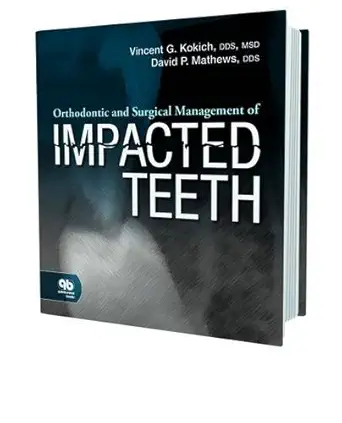 Buy Orthodontic and Surgical Management of Impacted Teeth (English, Paperback, Vincent G. Kokich, David P. Mathews) Online at Best Price - BookBajar