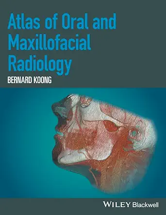 Buy ATLAS OF ORAL AND MAXILLOFACIAL RADIOLOGY (HB 2017) (English, Kindle Edition, KOONG B) Online at Best Price - BookBajar