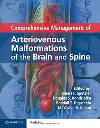 Buy Comprehensive Management of Arteriovenous Malformations of the Brain and Spine (English, Kindle Edition, Robert F. Spetzler, Douglas S. Kondziolka, Randall T. Higashida, M. Yashar S. Kalani) Online at Best Price - BookBajar