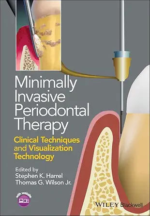 Buy Minimally Invasive Periodontal Therapy: Clinical Techniques and Visualization Technology (English, Kindle Edition, Stephen K. Harrel, Thomas G. Wilson Jr.) Online at Best Price - BookBajar