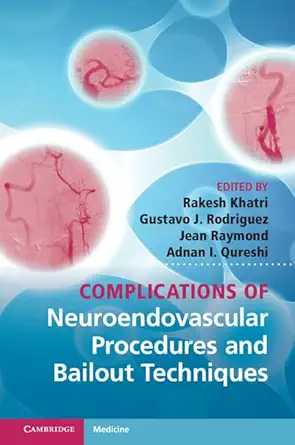 Buy Complications of Neuroendovascular Procedures and Bailout Techniques (English, Kindle Edition, Rakesh Khatri, Gustavo J. Rodriguez, Jean Raymond, Adnan I. Qureshi) Online at Best Price - BookBajar