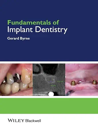 Buy Fundamentals of Implant Dentistry (English, Kindle Edition, Gerard Byrne) Online at Best Price - BookBajar