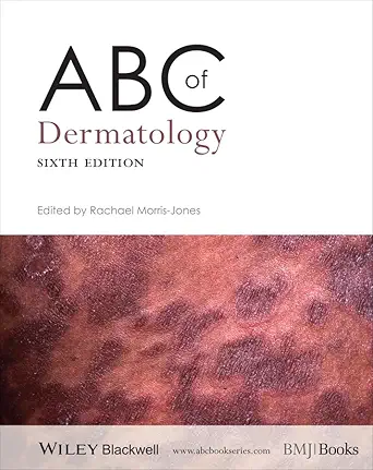 Buy ABC of Dermatology (ABC Series) (English, Paperback, Rachael Morris–Jones) Online at Best Price - BookBajar