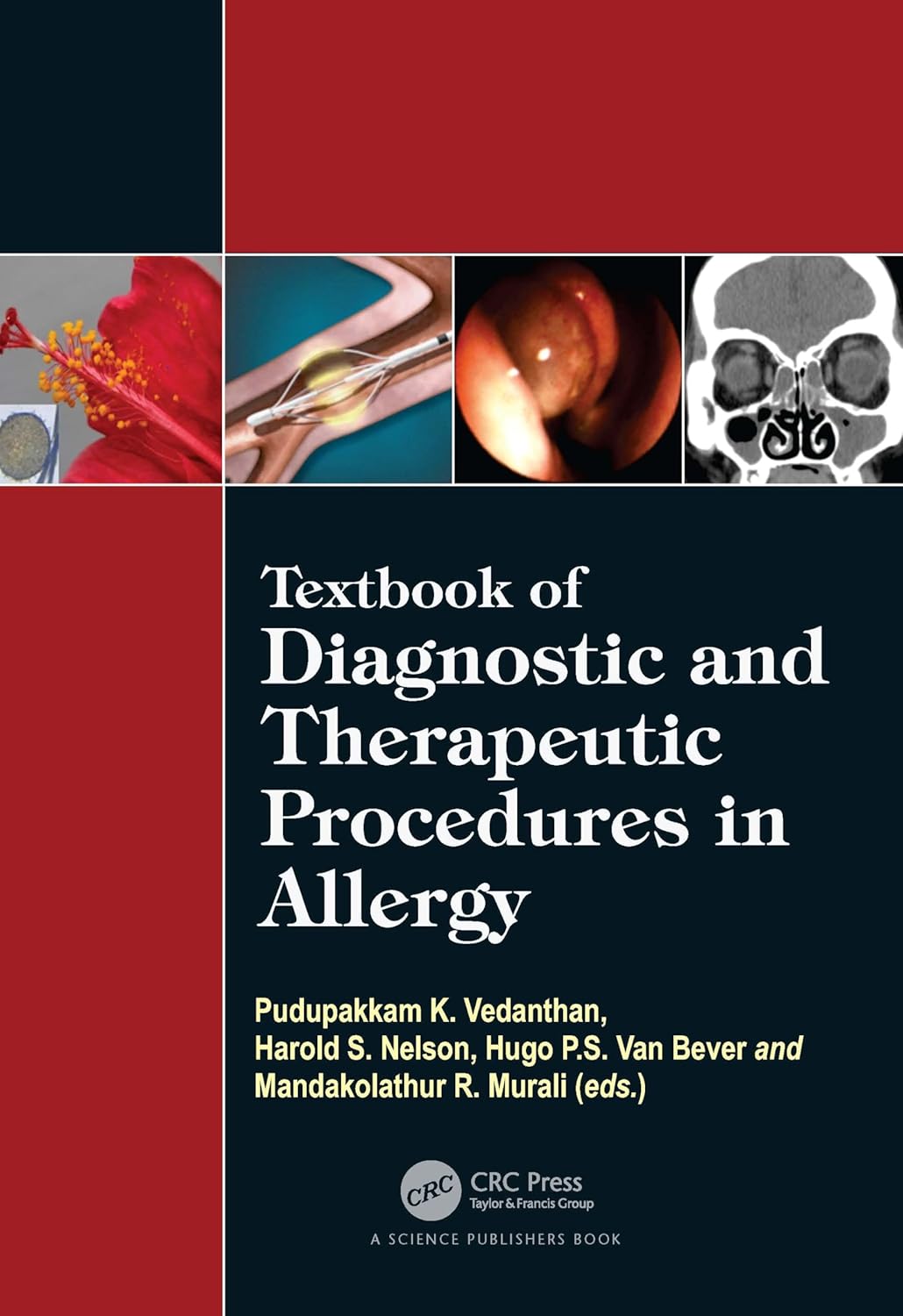 Buy Textbook of Diagnostic and Therapeutic Procedures in Allergy (English, Kindle Edition, Pudupakkam K. Vedanthan, Harold S. Nelson, Hugo Van Bever, Mandakolathur R Murali) Online at Best Price - BookBajar