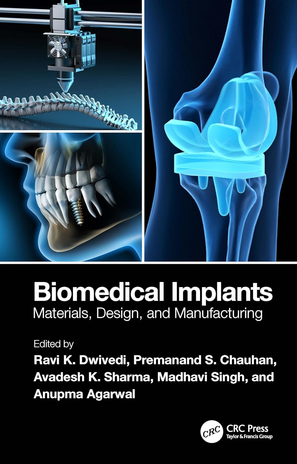 Buy Biomedical Implants: Materials, Design, and Manufacturing (English, Kindle Edition, Ravi K. Dwivedi, Premanand S. Chauhan, Avadesh K. Sharma, Madhavi Singh, Anupma Agarwal) Online at Best Price - BookBajar