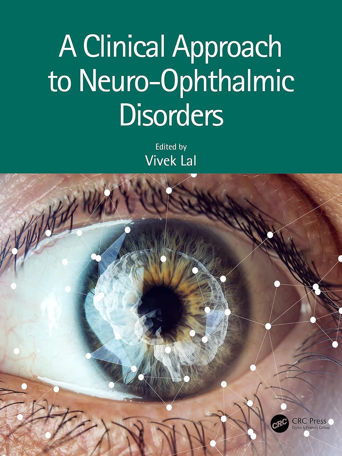 Buy A CLINICAL APPROACH TO NEURO OPHTHALMIC DISORDERS (PB 2023) (English, Hardcover, Vivek Lal) Online at Best Price - BookBajar