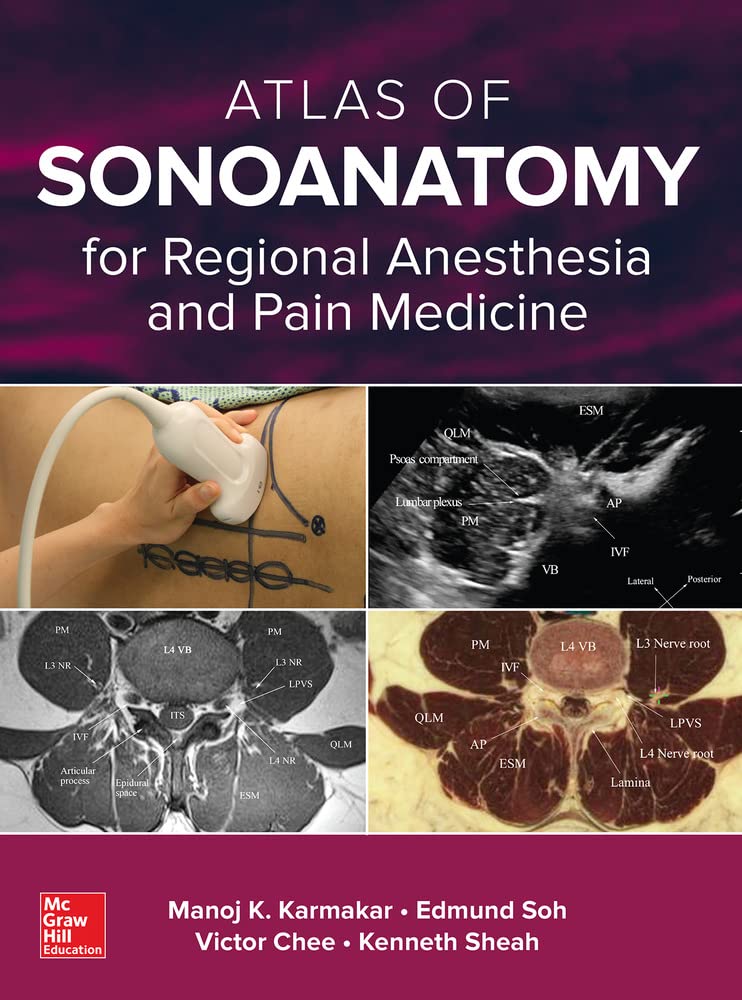 Buy Atlas of Sonoanatomy for Regional Anesthesia and Pain Medicine (English, Kindle Edition, Manoj Karmakar) Online at Best Price - BookBajar