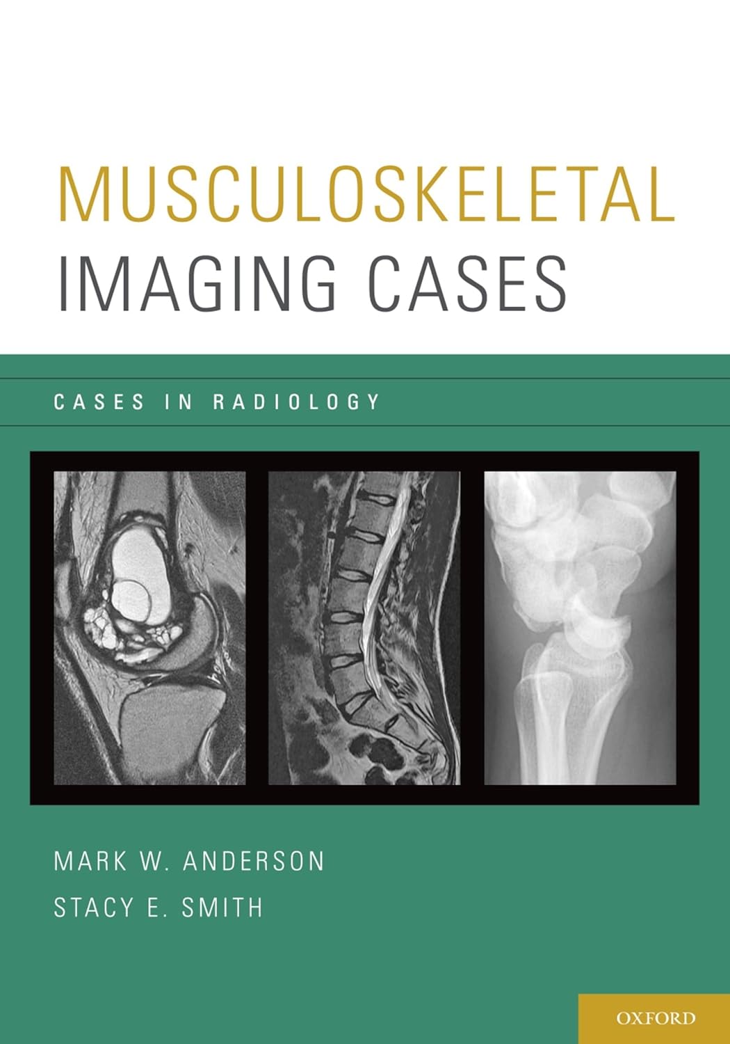 Buy Musculoskeletal Imaging Cases (Cases In Radiology) (English, Paperback, Mark W. Anderson, Stacy E. Smith) Online at Best Price - BookBajar