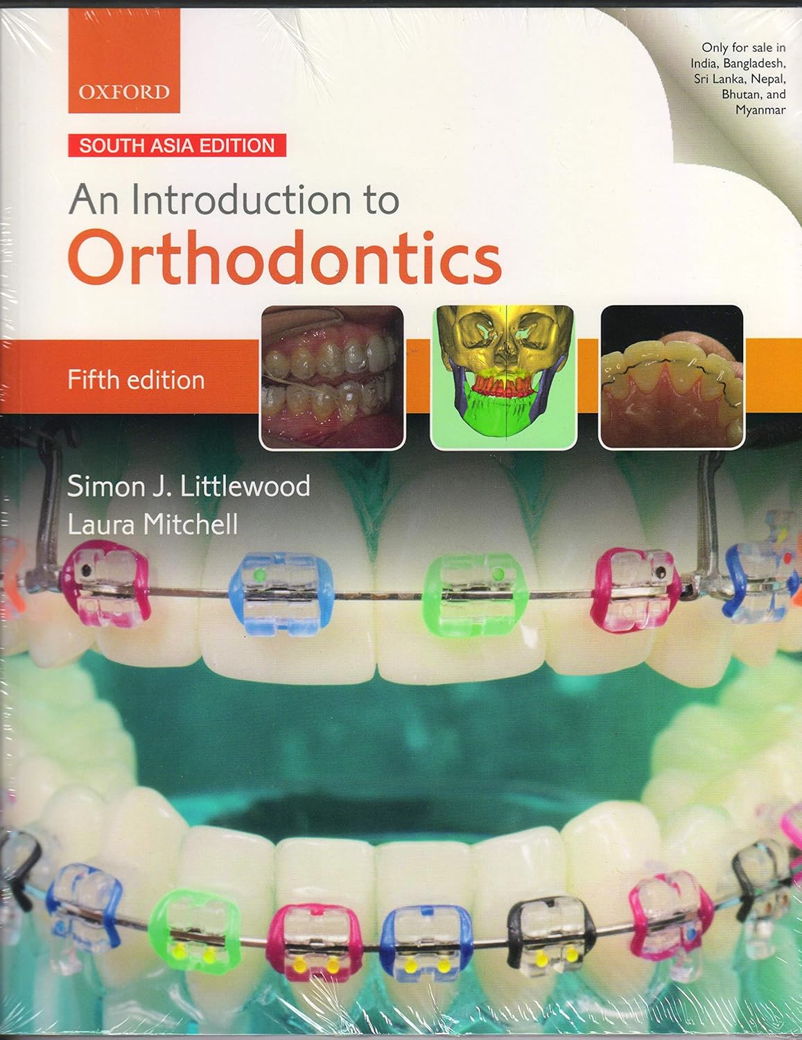 Buy An Introduction to Orthodontics (English, Paperback, Simon J. Littlewood and Laura Mitchell) Online at Best Price - BookBajar