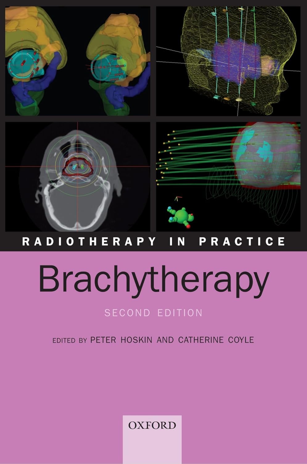 Buy Radiotherapy in Practice - Brachytherapy (English, Paperback, Peter Hoskin, Catherine Coyle) Online at Best Price - BookBajar