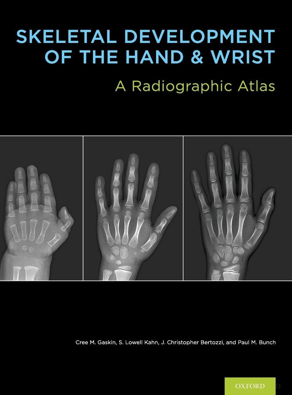 Buy Skeletal Development of the Hand and Wrist: A Radiographic Atlas and Digital Bone Age Companion (English, Kindle Edition, M.D. Gaskin, Cree M., M.D. Kahn, S. Lowell, M.D. Bertozzi, J. Christoper, M.D. Bunch, Paul M.) Online at Best Price - BookBajar