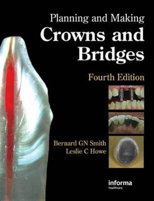 Buy Planning and Making Crowns and Bridges (English, Paperback, Unknown) Online at Best Price - BookBajar