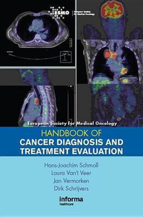 Buy ESMO Handbook of Cancer Diagnosis and Treatment Evaluation (English, Paperback, Unknown) Online at Best Price - BookBajar