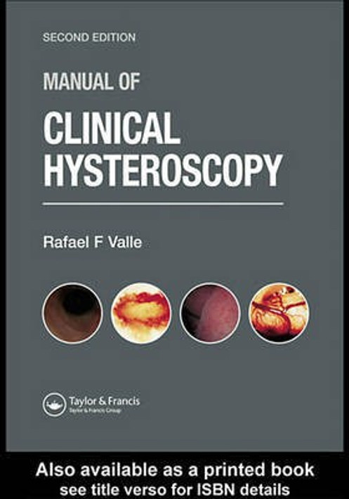 Buy Manual of Clinical Hysteroscopy, Second Edition (English, Paperback, Unknown) Online at Best Price - BookBajar