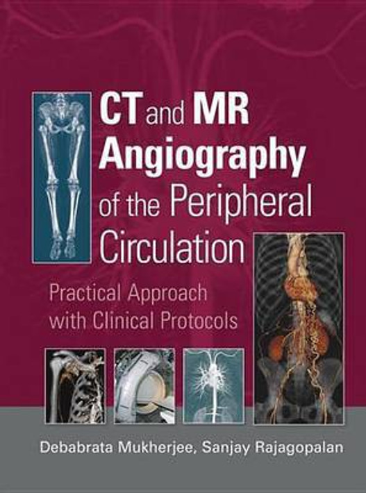 Buy CT and MR Angiography of the Peripheral Circulation (English, Paperback, Unknown) Online at Best Price - BookBajar
