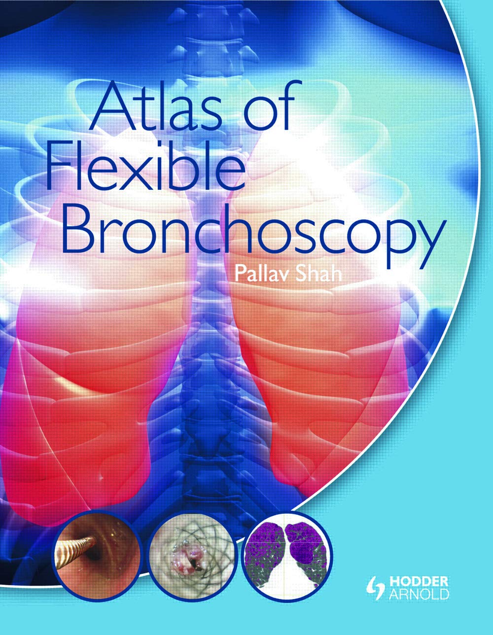 Buy ATLAS OF FLEXIBLE BRONCHOSCOPY (HB 2011) (English, Kindle Edition, Pallav Shah) Online at Best Price - BookBajar