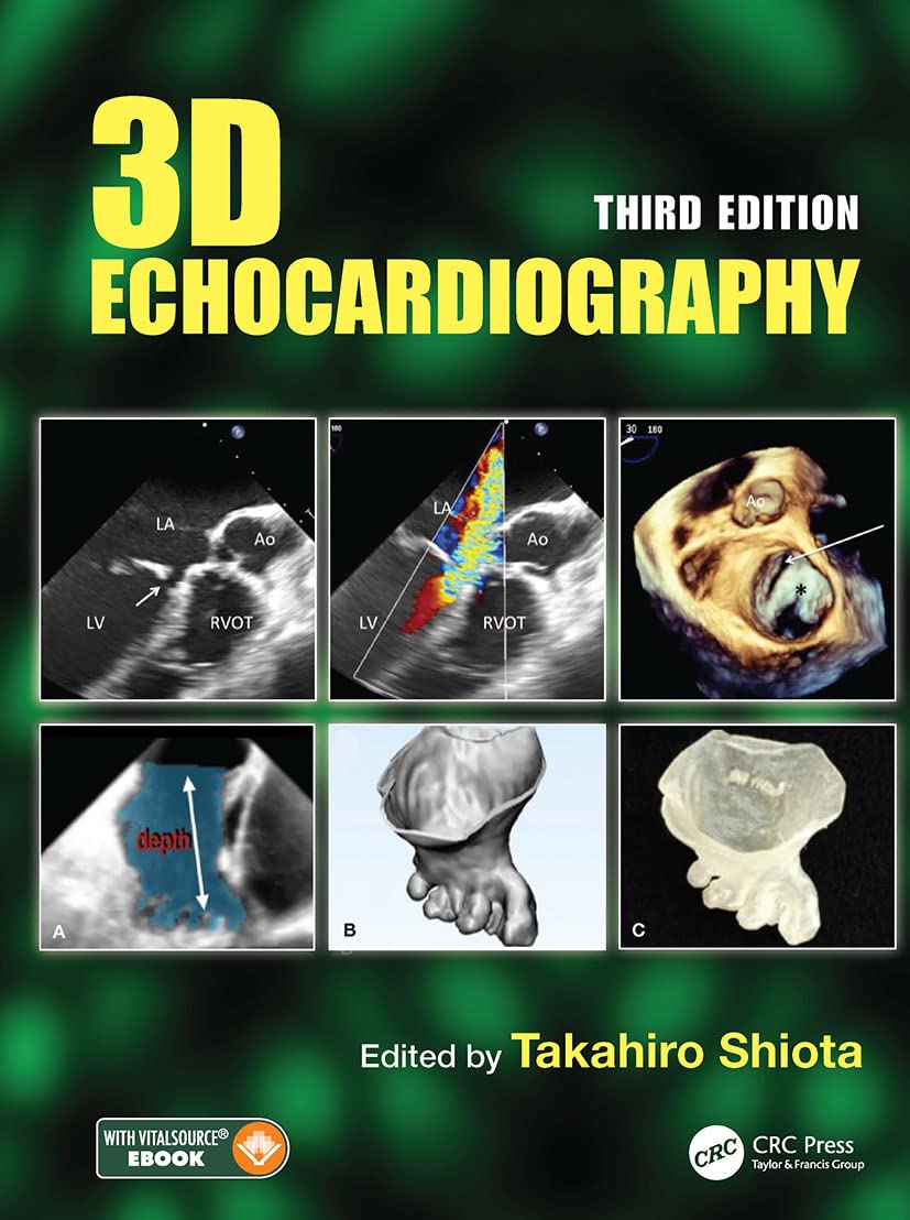Buy 3D Echocardiography (English, Hardcover, Takahiro Shiota) Online at Best Price - BookBajar