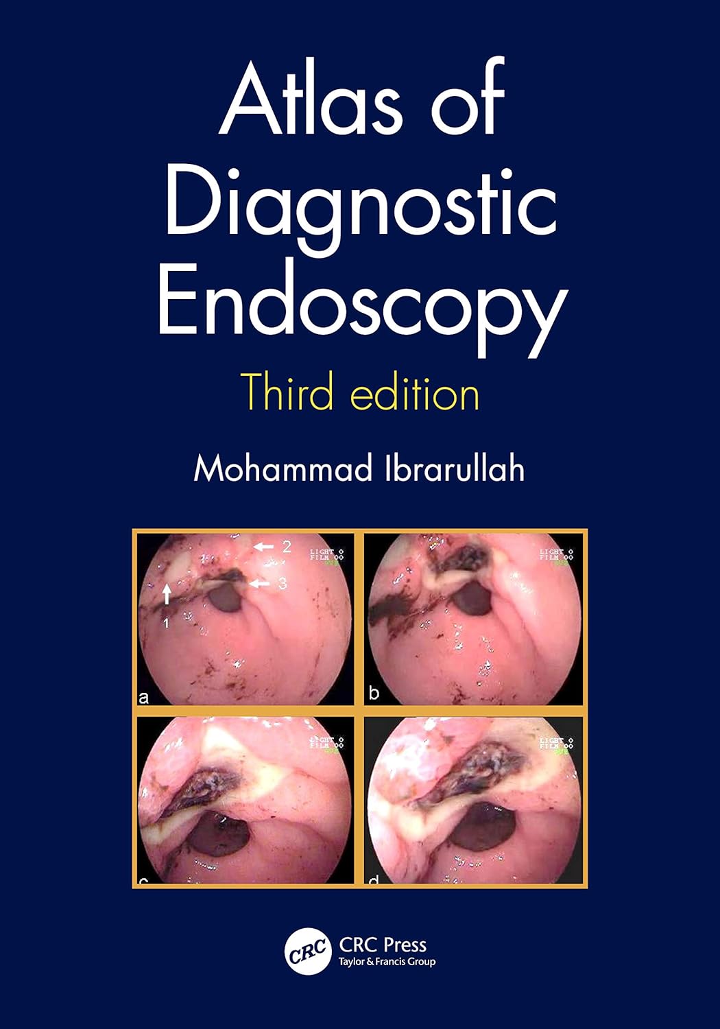 ATLAS OF DIAGNOSTIC ENDOSCOPY 3ED (HB 2020) (English, Kindle Edition, Mohammad Ibrarullah) - Image 1 - BookBajar