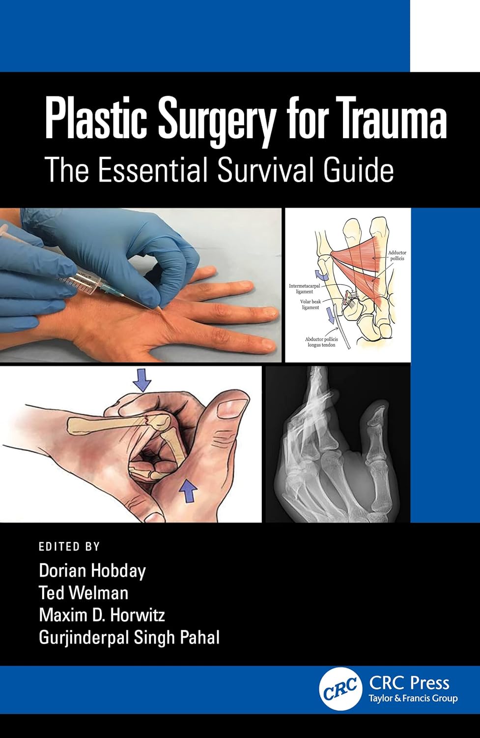Buy Plastic Surgery for Trauma: The Essential Survival Guide (English, Kindle Edition, Dorian Hobday, Ted Welman, Maxim D. Horwitz, Gurjinderpal Singh Pahal) Online at Best Price - BookBajar