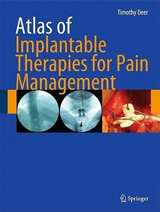 Buy Atlas of Implantable Therapies for Pain Management 1st Edition. Edition (English, Paperback, Unknown) Online at Best Price - BookBajar