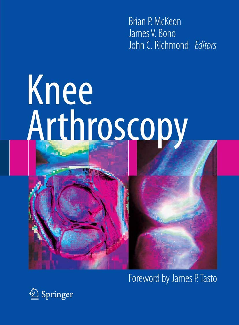 Buy Knee Arthroscopy (English, Kindle Edition, Brian P McKeon, James V Bono, John C Richmond MD) Online at Best Price - BookBajar