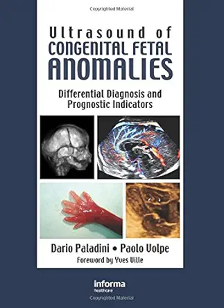 Buy Ultrasound of Congenital Fetal Anomalies (English, Hardcover, Dario Paladini, Paolo Volpe) Online at Best Price - BookBajar