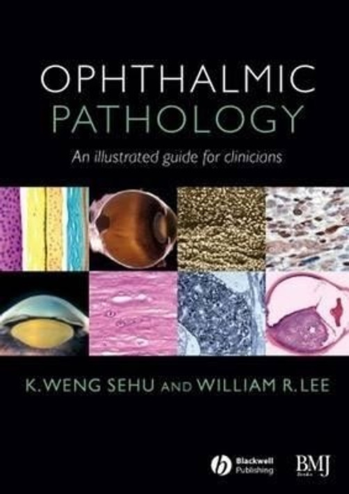 Buy Ophthalmic Pathology (English, Paperback, Unknown) Online at Best Price - BookBajar