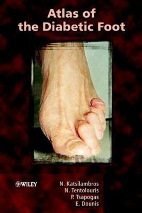 Buy Atlas of the Diabetic Foot (English, Paperback, Unknown) Online at Best Price - BookBajar