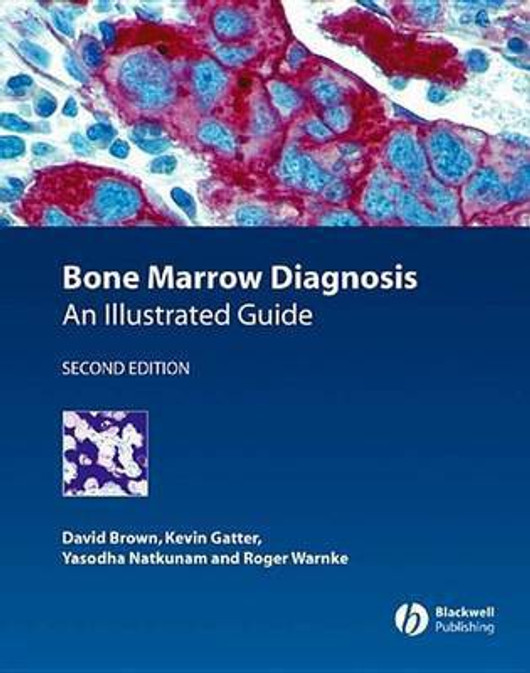 Buy Bone Marrow Diagnosis (English, Paperback, Unknown) Online at Best Price - BookBajar