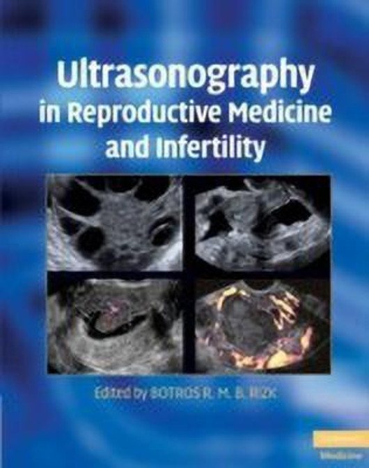 Buy Ultrasonography in Reproductive Medicine and Infertility (English, Paperback, Unknown) Online at Best Price - BookBajar