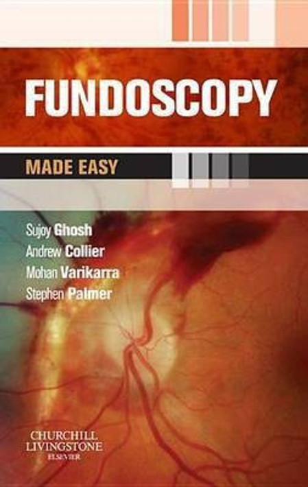 Buy Fundoscopy Made Easy E-Book (English, Paperback, Unknown) Online at Best Price - BookBajar