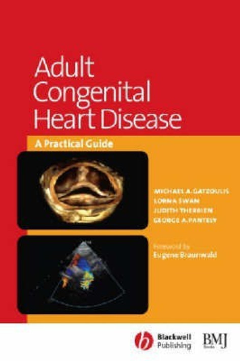 Buy Adult Congenital Heart Disease (English, Paperback, Unknown) Online at Best Price - BookBajar