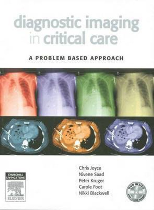 Buy Diagnostic Imaging in Critical Care - A Problem Based Approach (English, Paperback, Unknown) Online at Best Price - BookBajar