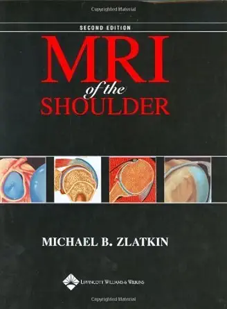 Buy MRI of the Shoulder (English, Hardcover, Michael B. Zlatkin) Online at Best Price - BookBajar