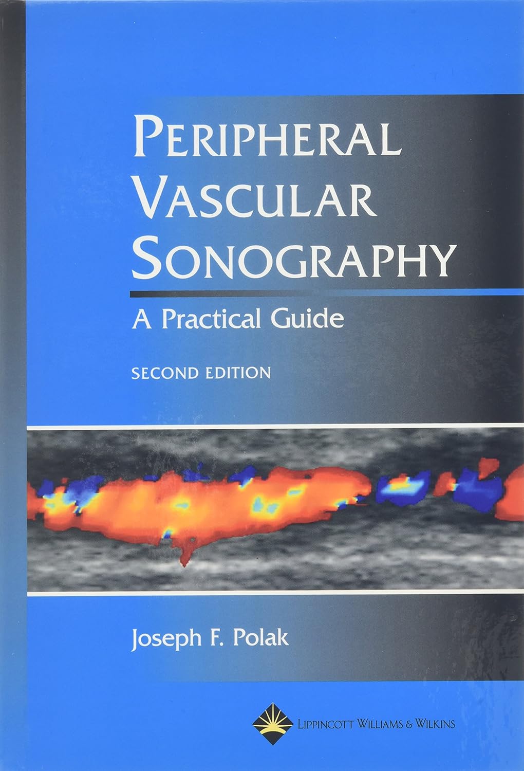 Buy Peripheral Vascular Sonography: A Practical Guide (English, Hardcover, Polak) Online at Best Price - BookBajar