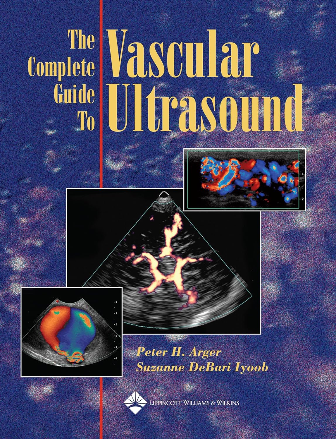 Buy The Complete Guide to Vascular Ultrasound (English, Paperback, Peter H. Arger, Suzanne DeBari Iyoob BS RDMS RVT) Online at Best Price - BookBajar