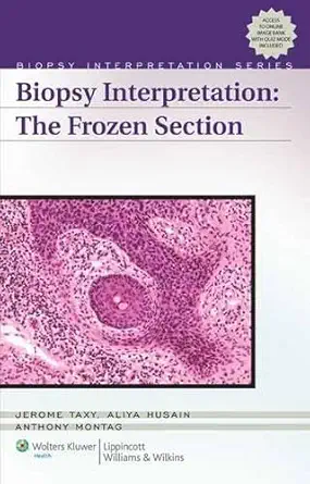 Buy Biopsy Interpretation The Frozen Section (Old) (Biopsy Interpretation Series) (English, Hardcover, Jerome B. Taxy, Aliya N. Husain, Anthony G. Montag) Online at Best Price - BookBajar