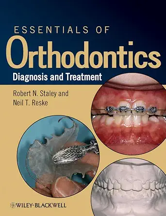Buy Essentials of Orthodontics: Diagnosis and Treatment (English, Paperback, Robert N. Staley) Online at Best Price - BookBajar