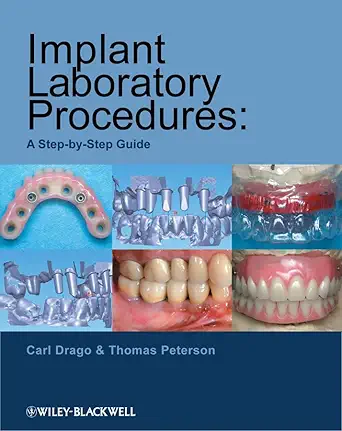 Buy Implant Laboratory Procedures: A Step–by–Step Guide (English, Paperback, Carl Drago, Thomas Peterson) Online at Best Price - BookBajar