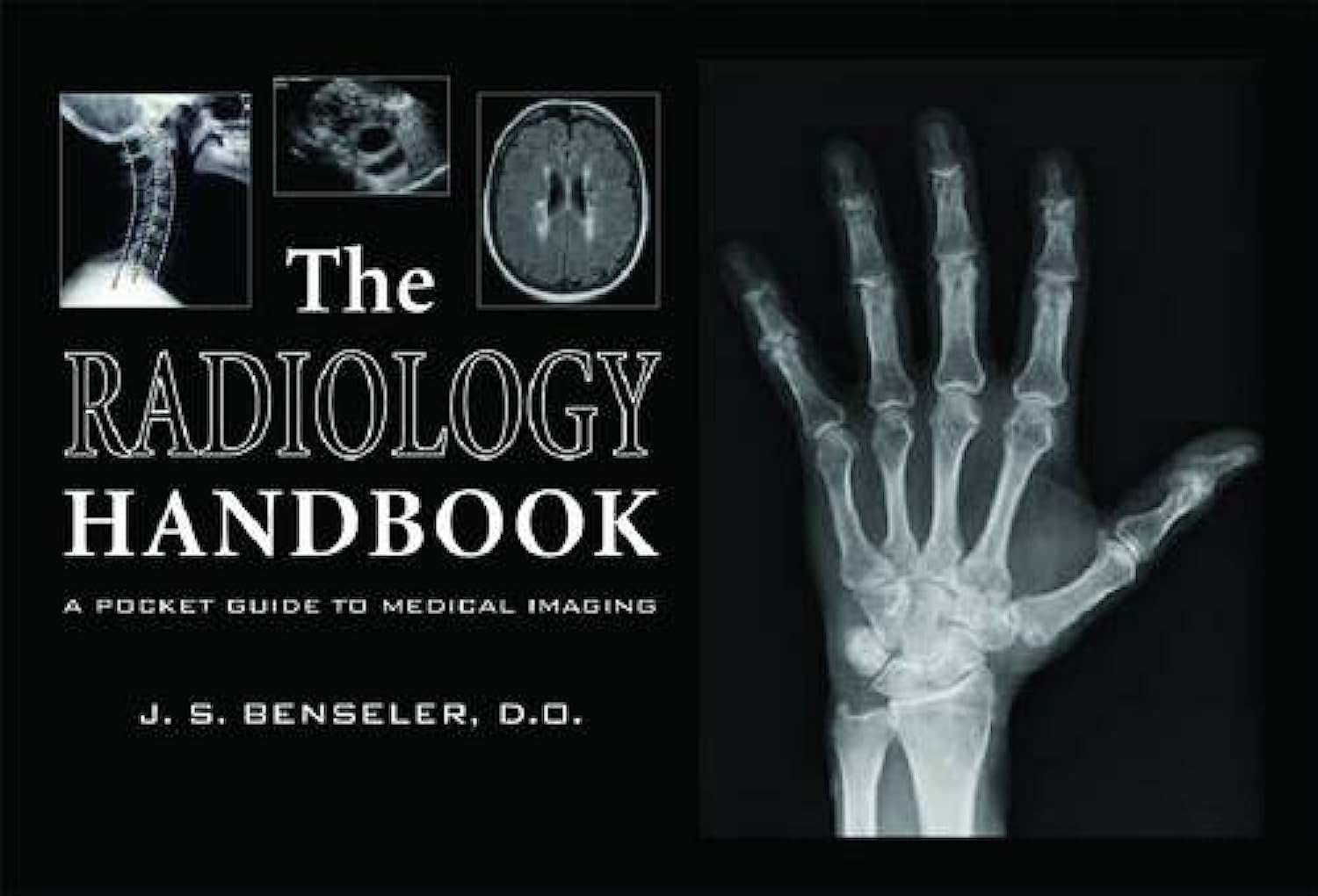 Buy The Radiology Handbook: A Pocket Guide to Medical Imaging (White Coat Pocket Guide Series) (English, Kindle Edition, J. S. Benseler) Online at Best Price - BookBajar