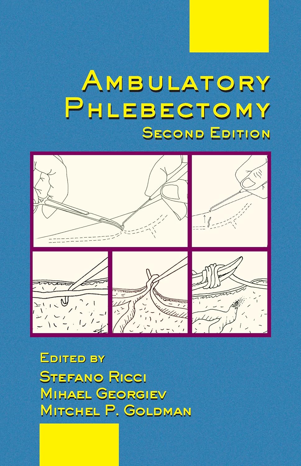 Buy Ambulatory Phlebectomy: 31 (Basic and Clinical Dermatology) (English, Kindle Edition, Mitchel P. Goldman, Mihael Georgiev, Stefano Ricci) Online at Best Price - BookBajar