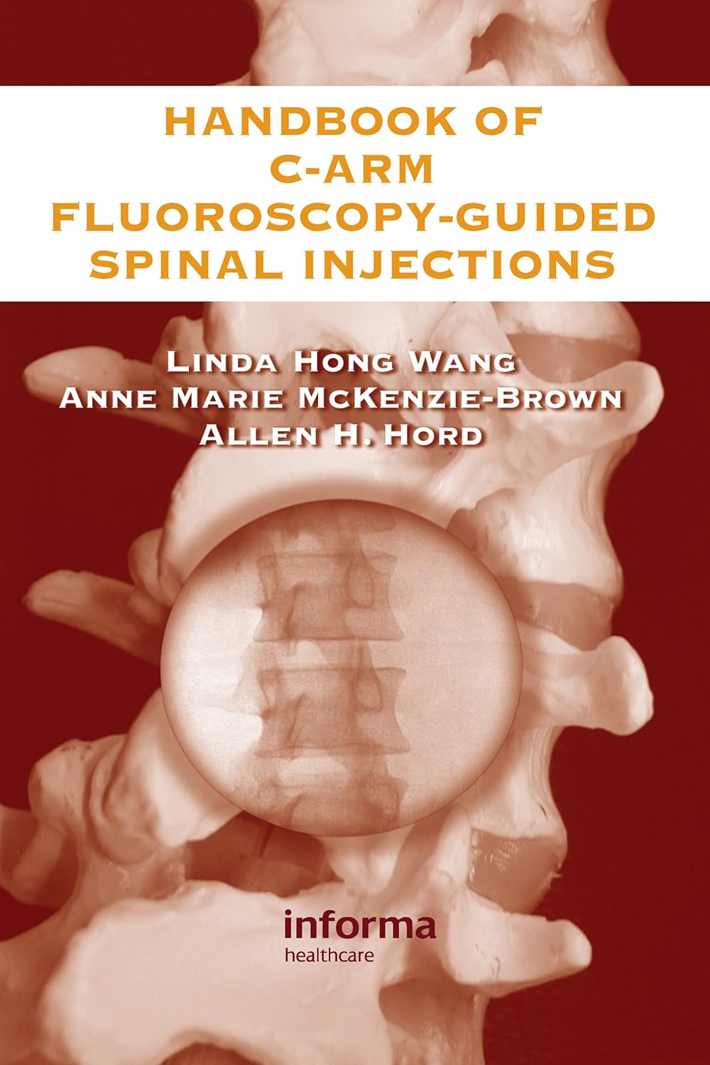 Buy Handbook Of C-Arm Fluoroscopy-Guided Spinal Injections (English, Kindle Edition, Linda Hong Wang, Anne Marie McKenzie-Brown, Allen Hord) Online at Best Price - BookBajar