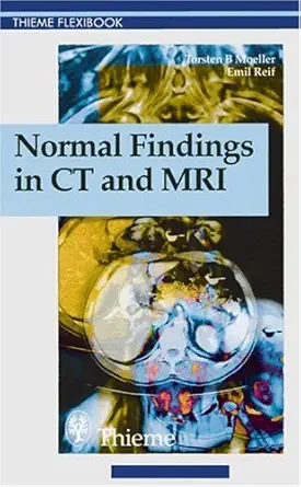 Buy Normal Findings in Ct and Mri (Thieme Flexibook) (English, Kindle Edition, Torsten Moeller, Emil Reif) Online at Best Price - BookBajar