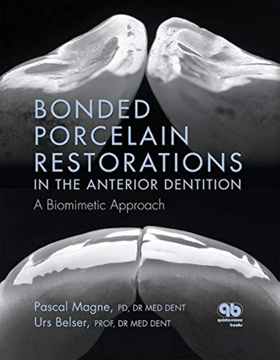Buy Bonded Porcelain Restorations in the Anterior Dentition: A Biomimetic Approach (English, Paperback, Pascal Magne, U. Belser) Online at Best Price - BookBajar