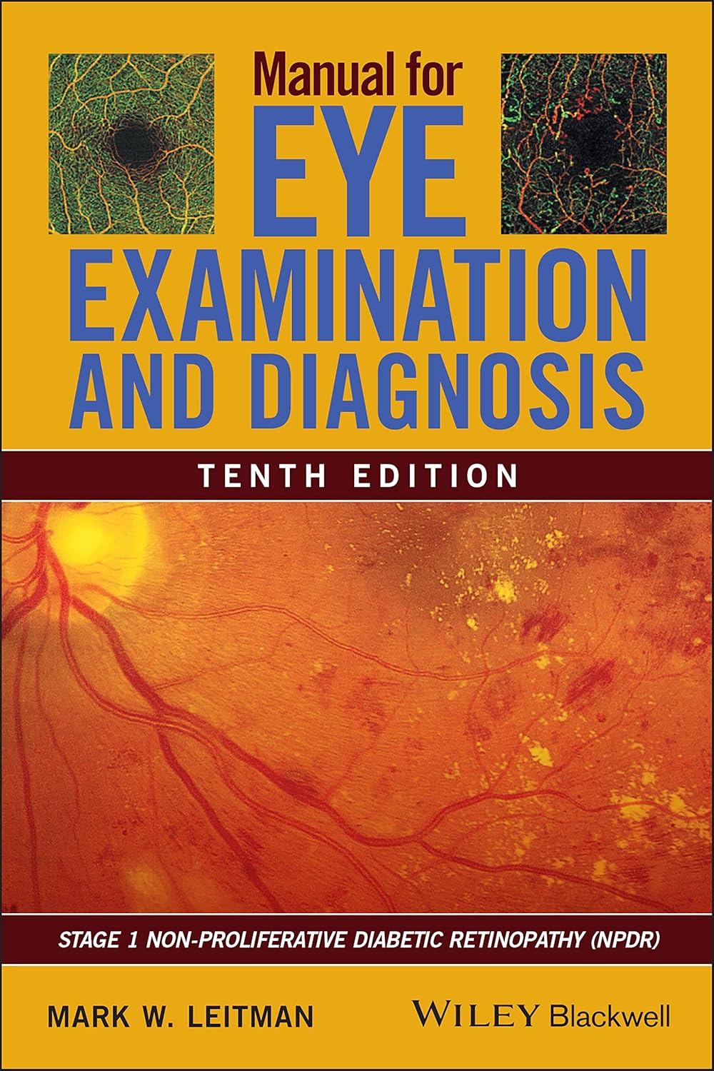 Manual for Eye Examination and Diagnosis (English, Paperback, Mark W. Leitman) - Image 1 - BookBajar