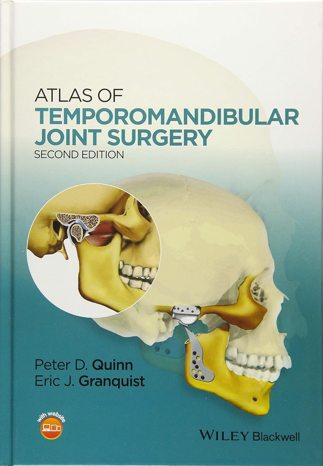 Buy ATLAS OF TEMPOROMANDIBULAR JOINT SURGERY 2ED (HB 2015) (English, Paperback, QUINN P.D.) Online at Best Price - BookBajar