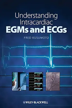 Understanding Intracardiac EGMs and ECGs (English, Paperback, Fred Kusumoto) - Image 1 - BookBajar