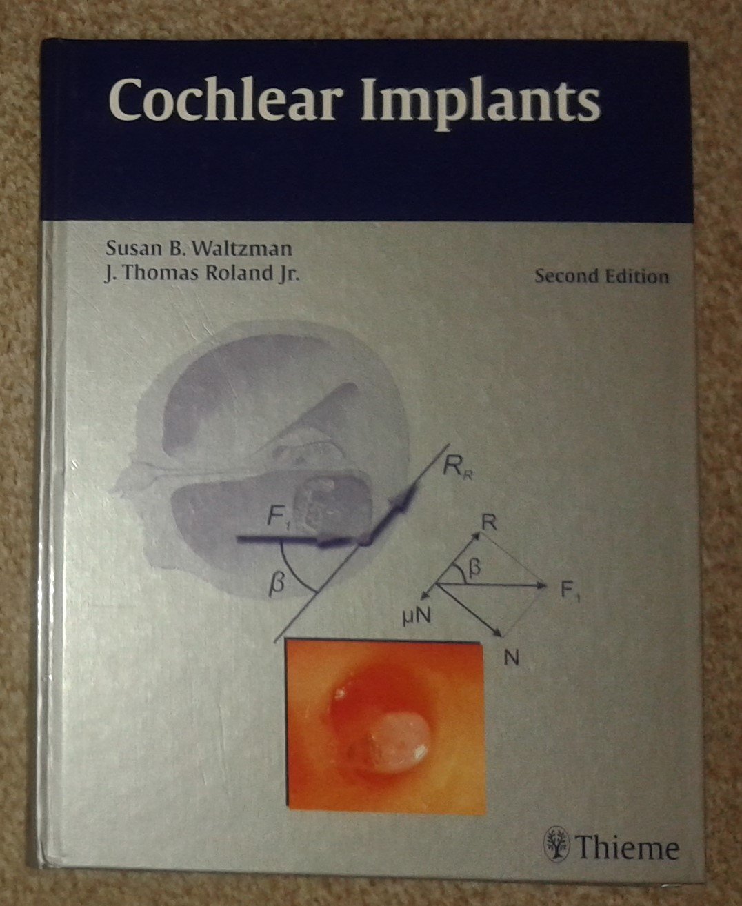 Cochlear Implants (English, Hardcover, Susan B Waltzman, J Thomas Roland Jr.) - Image 1 - BookBajar