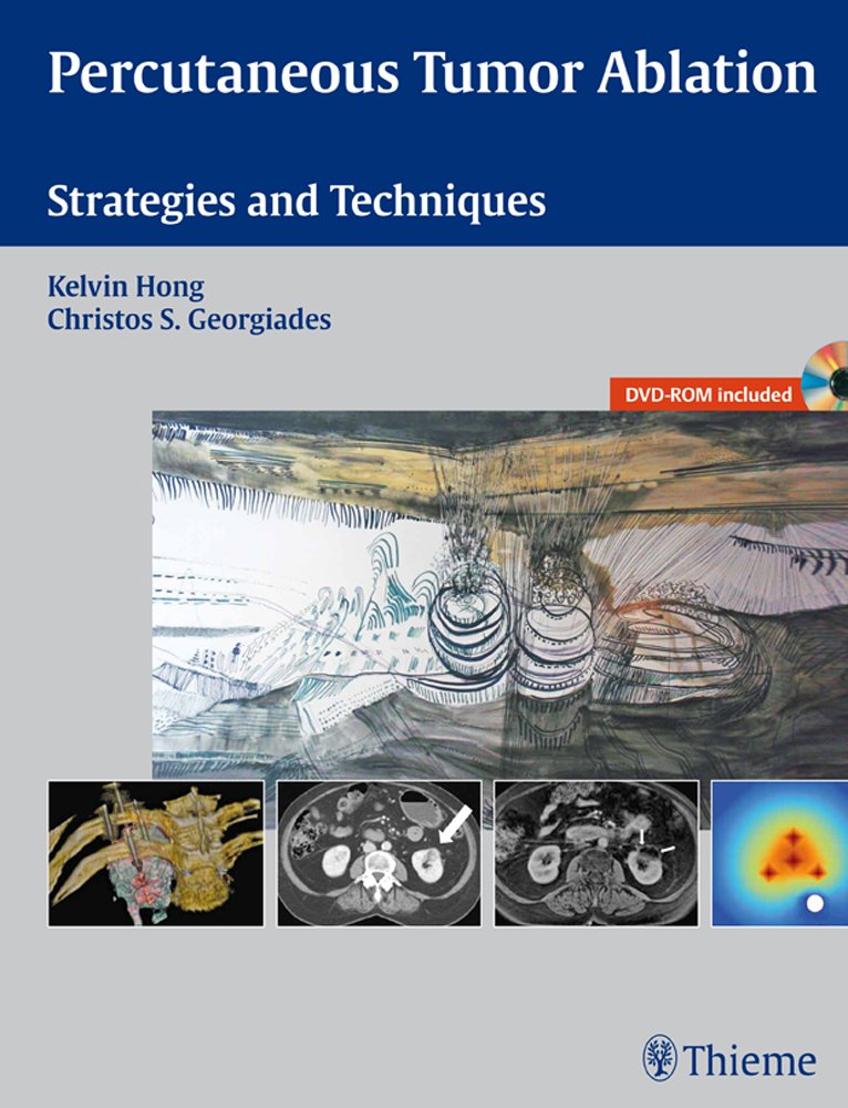 Percutaneous Tumor Ablation: Strategies and Techniques (English, Paperback, Kelvin Hong) - Image 1 - BookBajar