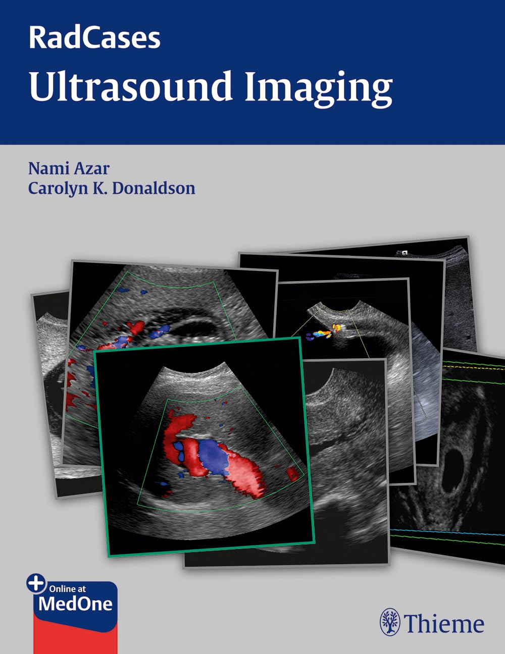 Radcases Ultrasound Imaging (English, Paperback, Nami R. Azar) - Image 1 - BookBajar